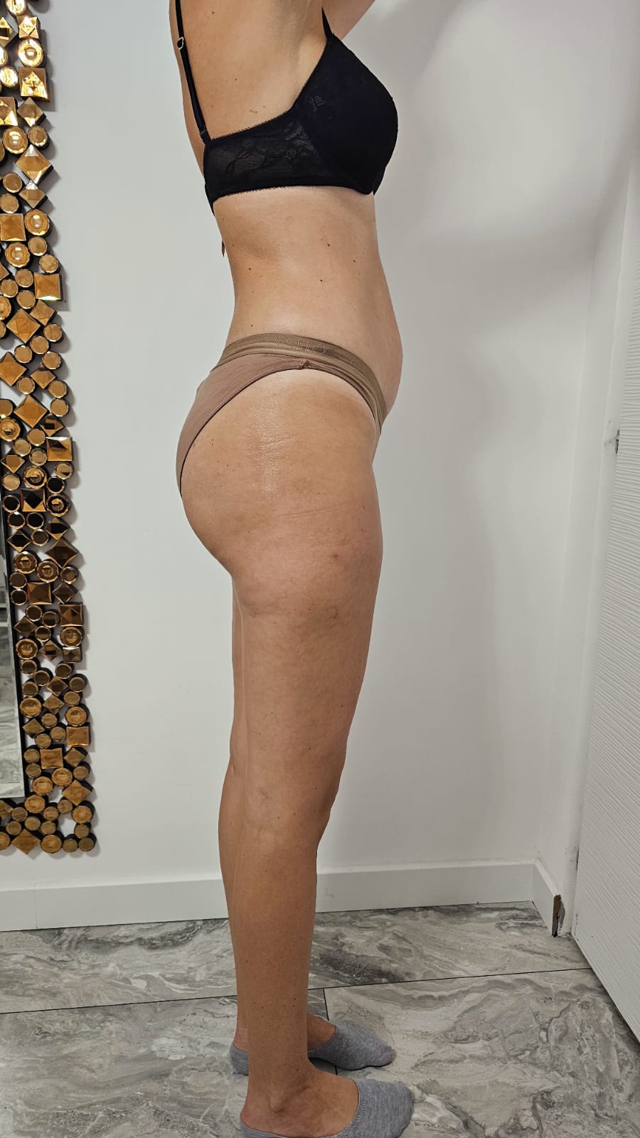 Eximia-After