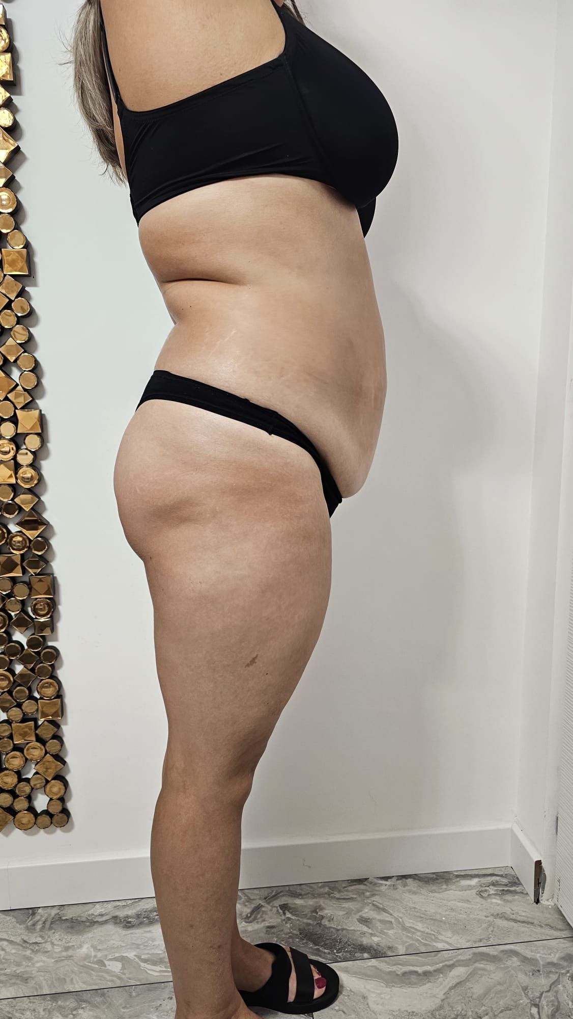 Eximia-Before