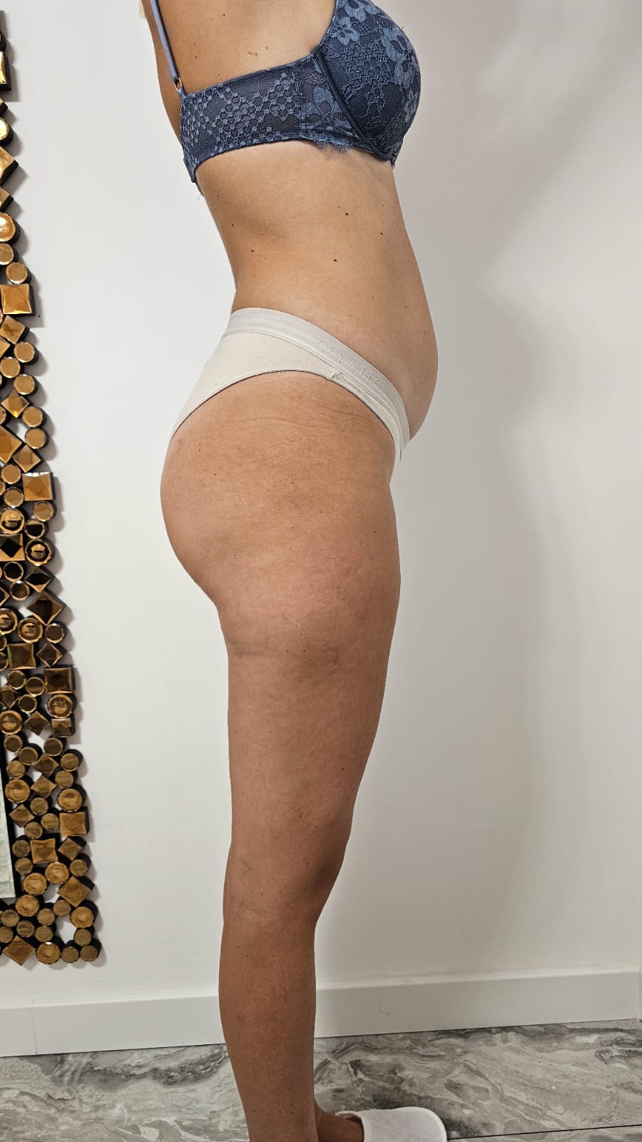 Eximia-Before